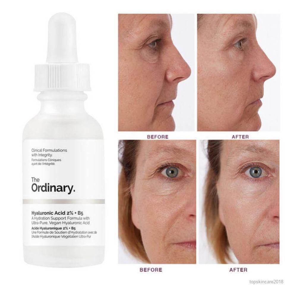 Anti-Aging Face Serum, 30 Ml